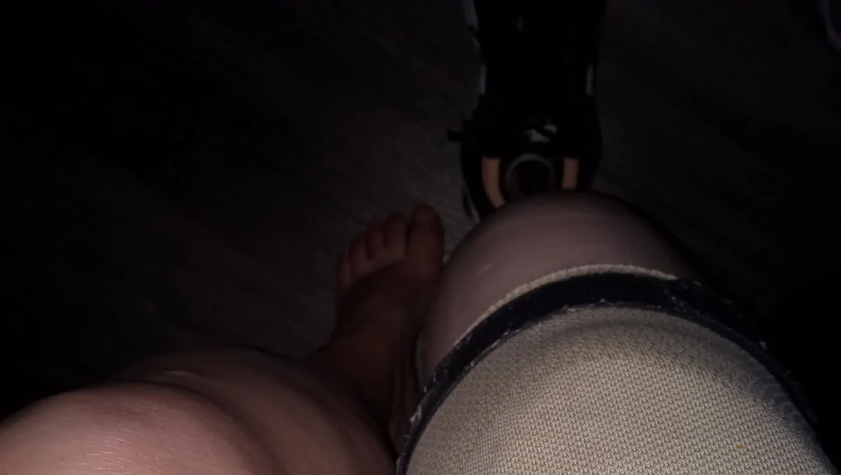 Help Replace Prosthetic Leg for a Brighter Future – Fundraiser Donation Help