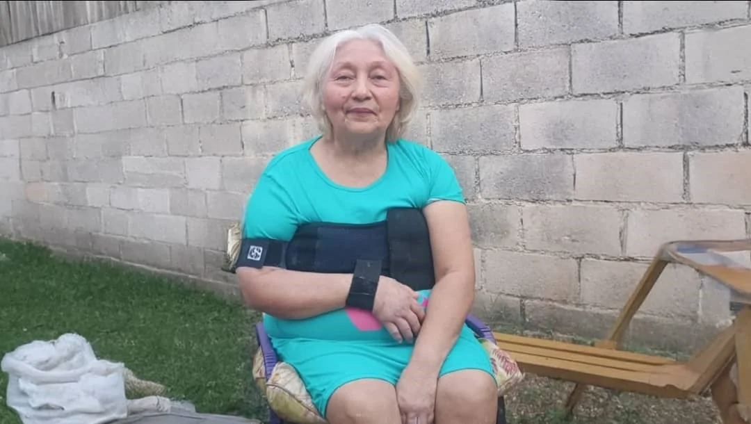 Ayuda a Carmen: ¡Dona para que recupere su brazo y su vida! – Fundraiser Donation Help