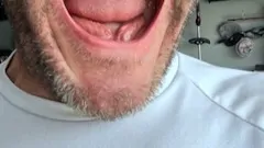 All teeth gone need help please. – Fundraiser Donation Help