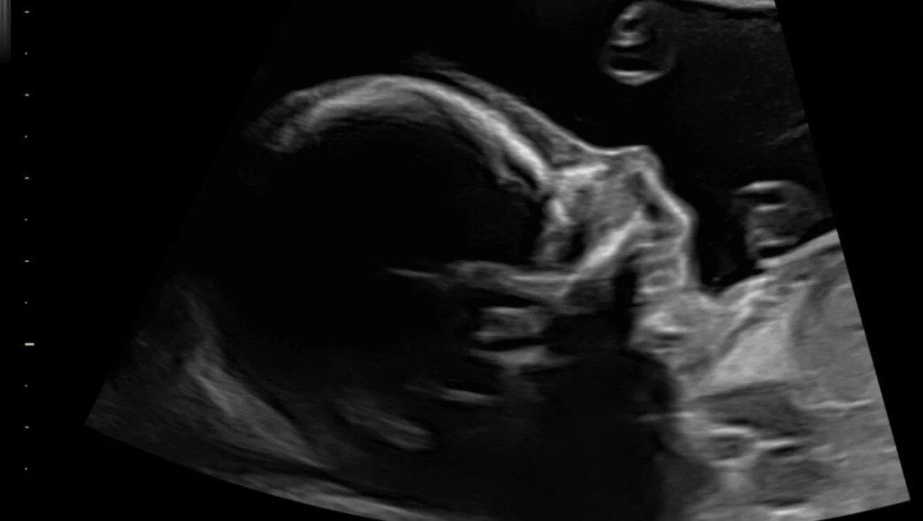 Help Olivia & Dillon with new baby’s Medical needs – GoFundMe Fundraiser gofundme Donation Help
