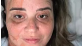Help Maria Recover from Severe Health Challenges – GoFundMe Fundraiser gofundme Donation Help