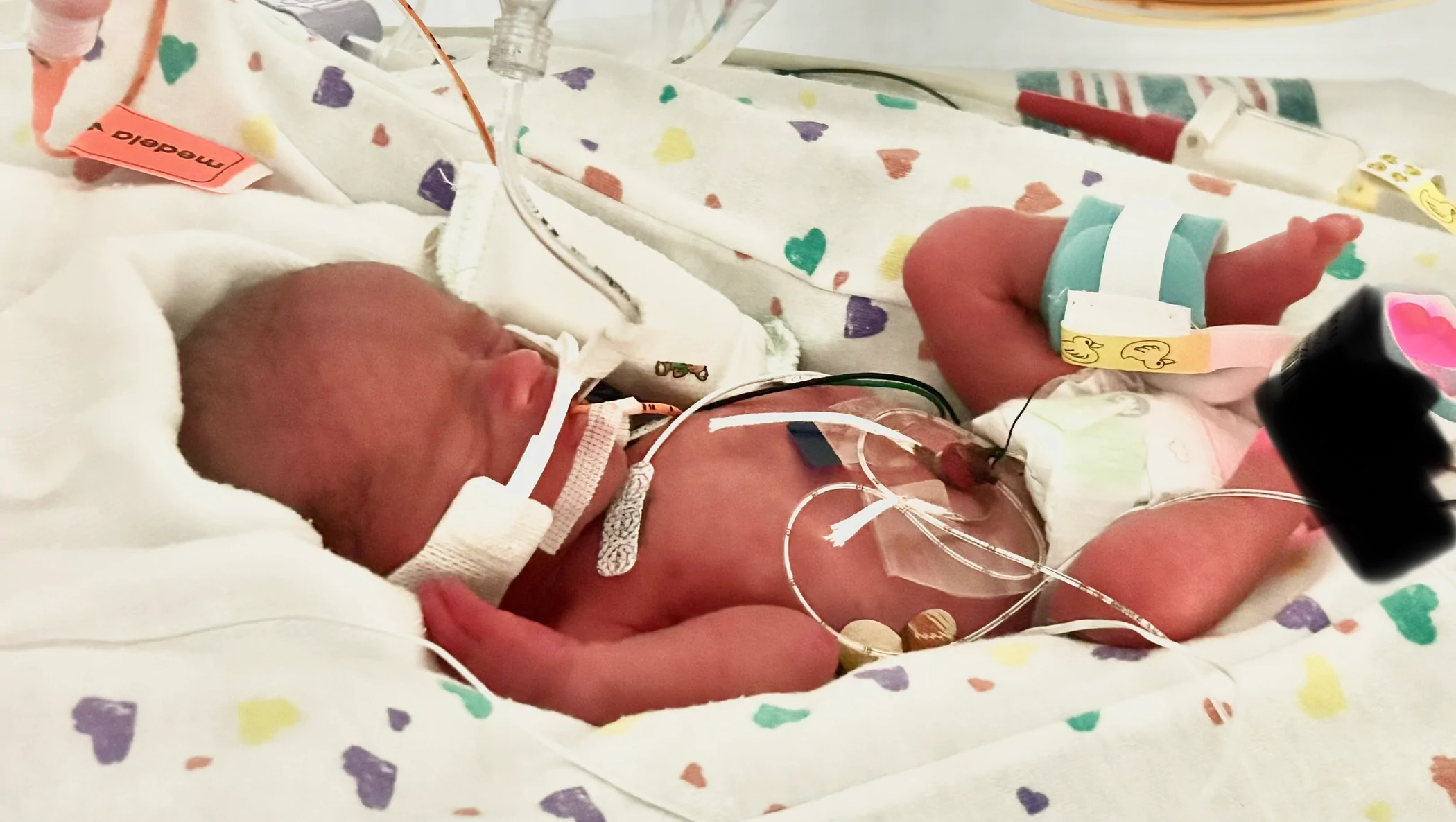Support for baby Theo – GoFundMe Fundraiser gofundme Donation Help
