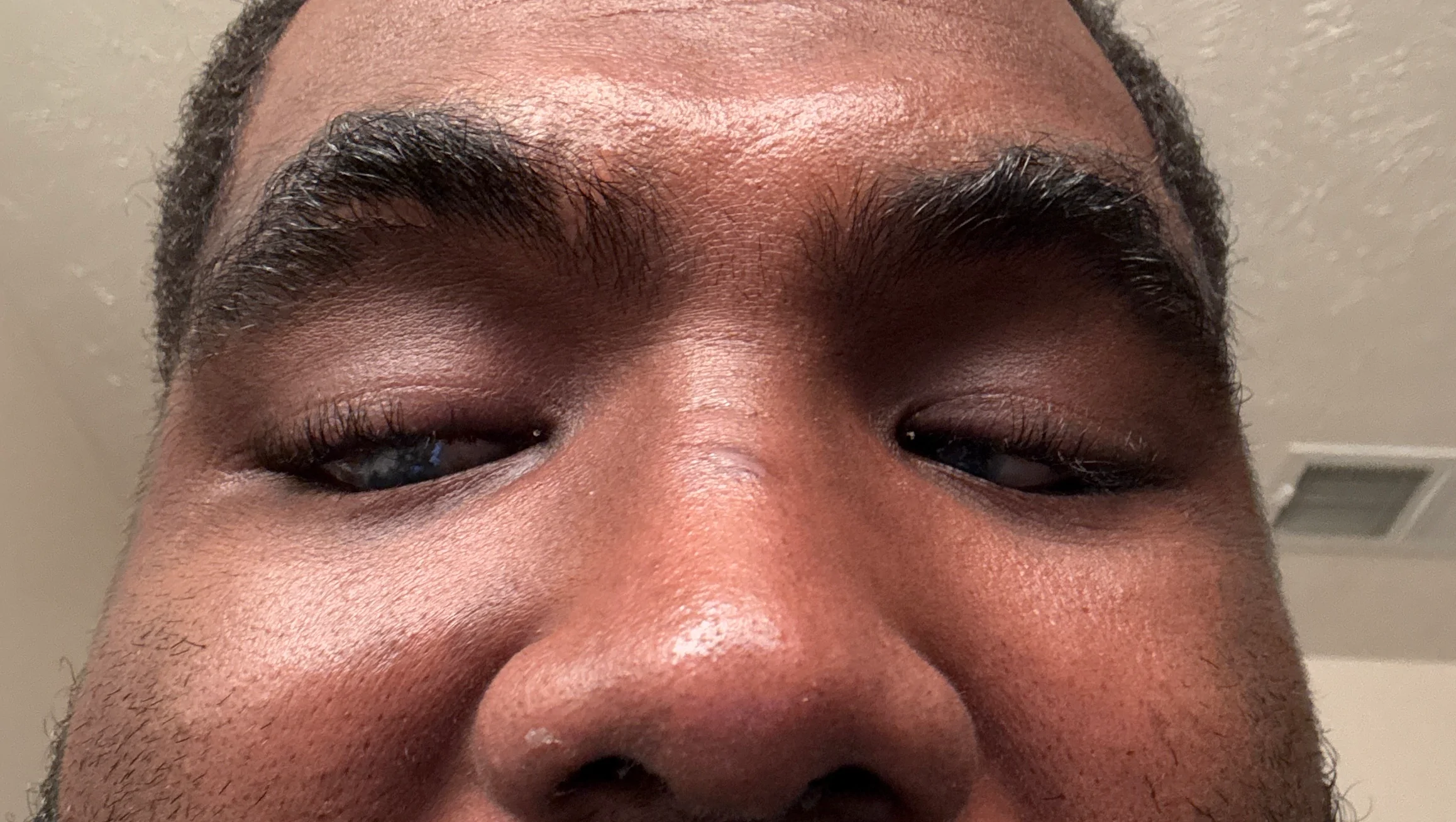 Restore Anthony’s Confidence with New Teeth – GoFundMe Fundraiser gofundme Donation Help